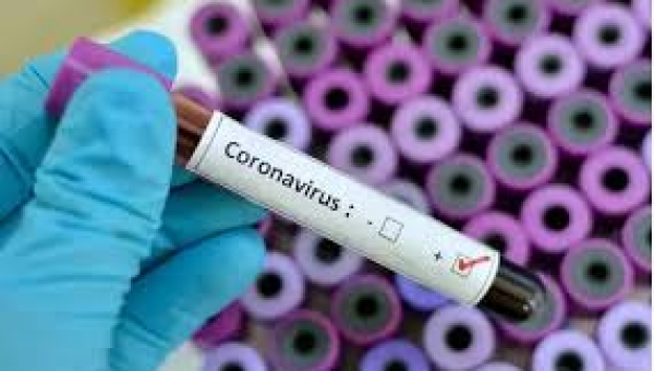 BREAKING: Nigeria records second coronavirus death 